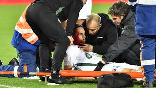 El espeluznante choque en la Liga de Francia que finalizó con el desmayo de un jugador | VIDEO