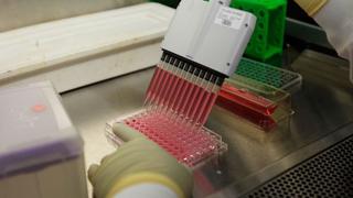 Vacuna experimental contra el VIH será probada en Sudáfrica