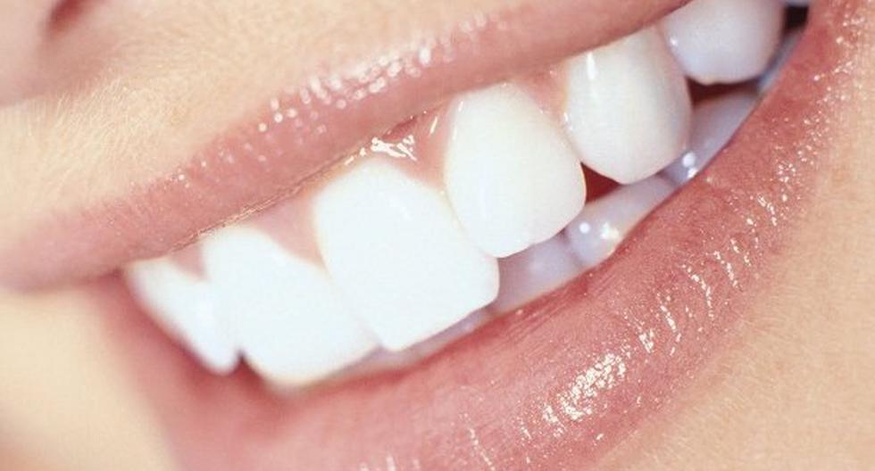 Los dientes sensibles son provocados por malos hábitos. (Foto: Difusión)