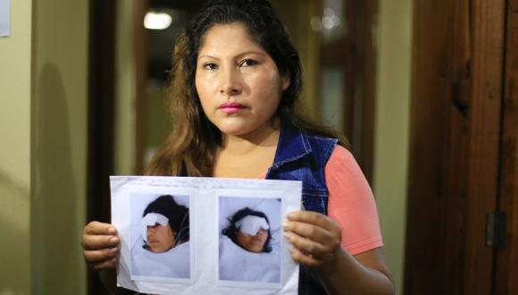 Lizet Quispe pide justicia para su hermana Yesica, quien lleva 20 días en coma por el brutal ataque que sufrió en Huaral. (Jessica Vicente / El Comercio)