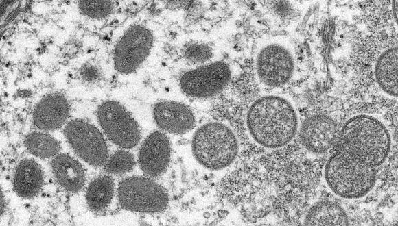 Una imagen de microscopio muestra partículas del virus de la viruela del mono de forma ovalada, así como partículas esféricas y en forma de media luna de viriones inmaduros, obtenidas de una muestra clínica de piel humana. (Cynthia S. Goldsmith, Russell egnery/CDC/Folleto vía REUTERS).