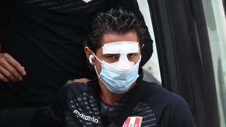 Gianluca Lapadula llegó al entrenamiento de la Selección Peruana con un vendaje en la nariz [FOTOS]