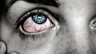 ¡Cuidado! Si tienes un virus común en los ojos podría dañarte más de lo que crees