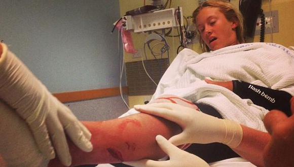 Facebook: surfista fue atacada por un tiburón y quedó así