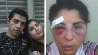 Facebook: mujer recibió brutal golpiza y lo denunció en la red