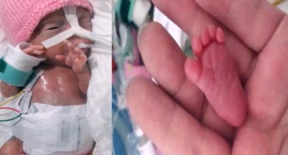 Emilia Grabarczyk es la recién nacida más pequeña del mundo. (Foto: Captura)