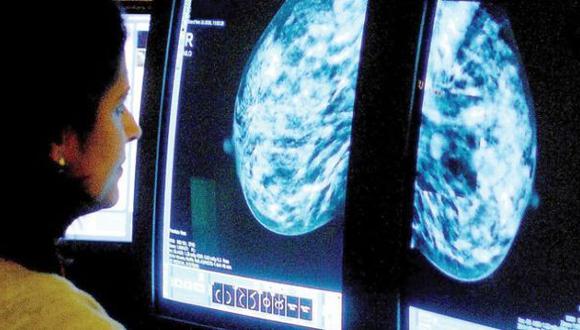Estudio cuestiona la exactitud de biopsias en cáncer de mama