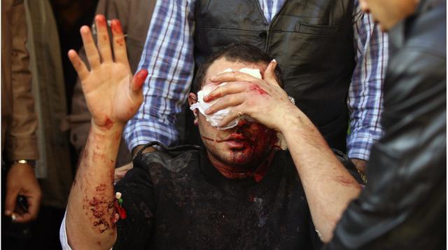 El Cairo: cinco muertos y 88 heridos por triple atentado - 1