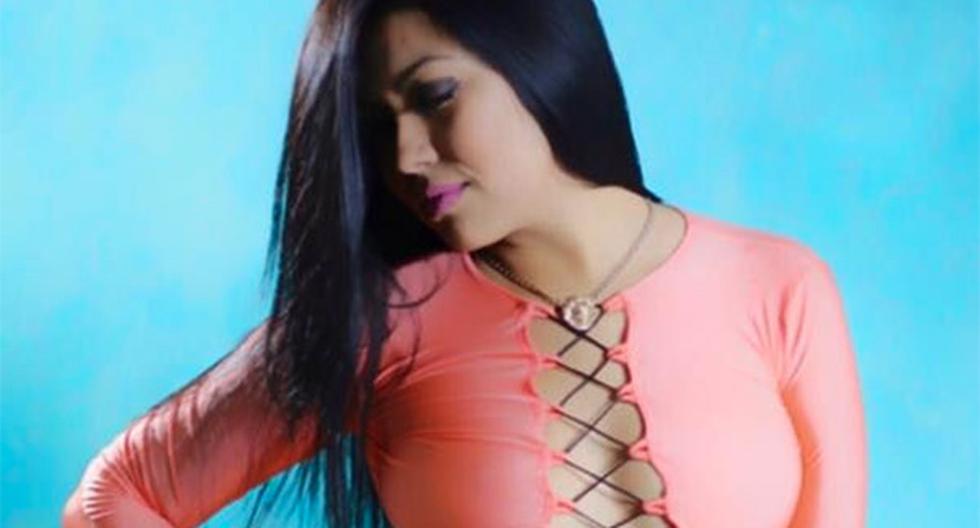 El Poder Judicial de Lambayeque pidió prisión preventiva para José Román Quiroz, quien desfiguró a la modelo Karen Cassaró. (Foto: Facebook)