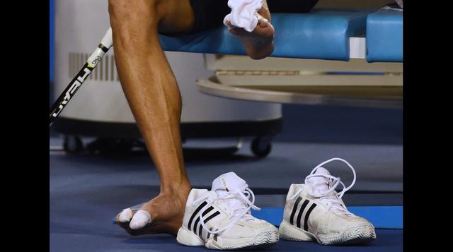 Novak Djokovic: así sufren los pies del número uno del mundo - 6
