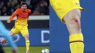 Lionel Messi se lesionó durante el PSG-Barcelona y fue sustituido