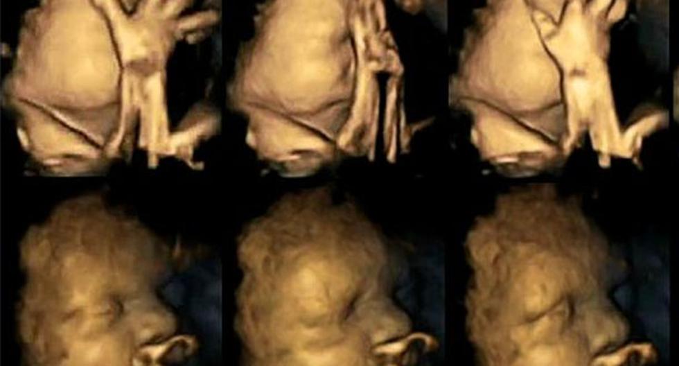 Los fetos hacen muecas por adicción al tabaco de las madres. (Foto: The Times)