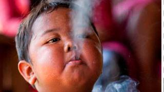 Así luce hoy Aldi Rizal, el bebé que fumaba 40 cigarrillos al día 
