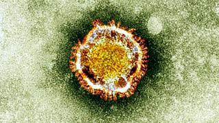 Coronavirus de Wuhan: ¿qué sabemos hasta ahora sobre esta enfermedad surgida en China?