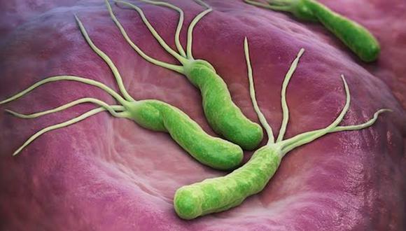Más de 60% de la población mundial ha estado expuesta a la bacteria Helicobacter pylori. (Foto: iLex)