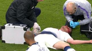 Tottenham vs. Ajax: Vertonghen sangró por este golpe que lo dejó mareado y sacó del partido | VIDEO