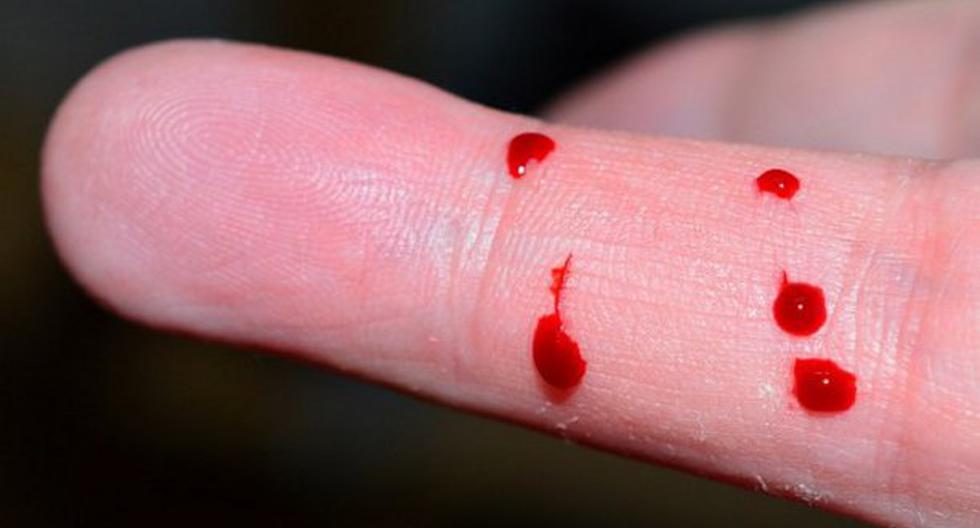 Un microscopio de teléfono móvil puede detectar parásitos en gota de sangre. (Foto: 7dias.com.do)