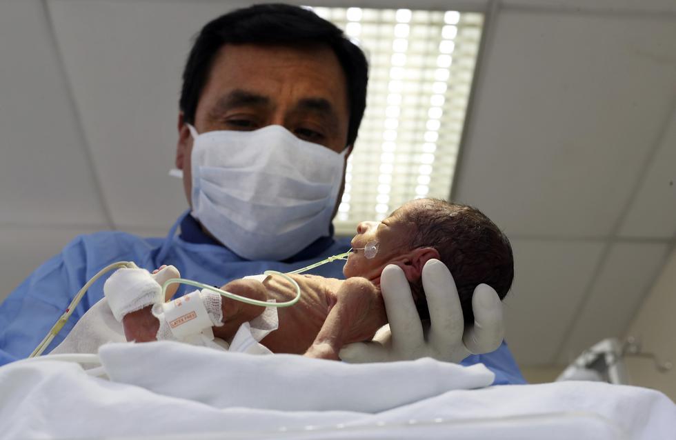 La Vida En 800 Gramos La Dura Batalla De Los Bebes Prematuros En El Peru Fotos Somos El Comercio Peru