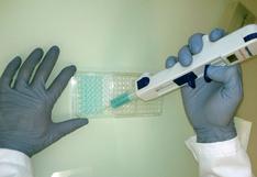 Marcador genético podría ayudar a salvar a pacientes con Hepatitis B crónica