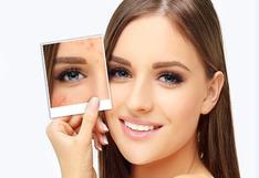 4 productos cosméticos para disimular las marcas de acné 