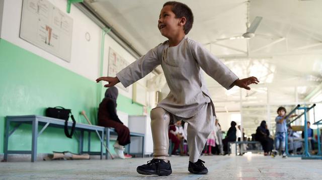 El niño, Ahmad Sayed Rahman, de cinco años, conmovió a Afganistán después de que un breve video donde aparece bailando sin esfuerzo con su nueva pierna. (Foto: AFP)