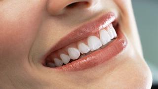 Consigue dientes más blancos con estos tips