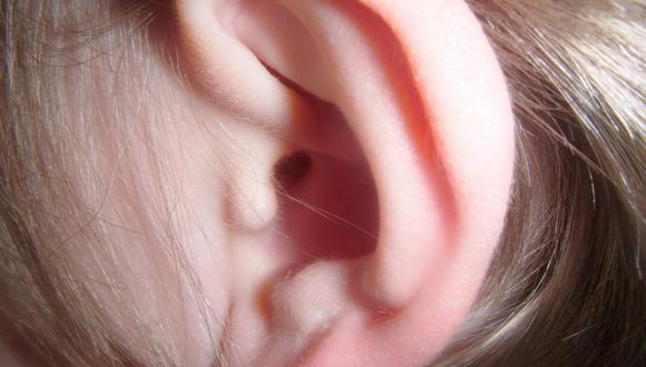 Esta sordera de más de 30 decibeles aparece en menos de 72 horas y se da en pacientes que no presentan antecedentes previos con la audición. (Foto: Publicdomainpictures)