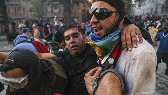 Con 22 muertos, más de 200 personas con trauma ocular y miles de heridos se saldan hasta ahora la inusitada convulsión que afecta a Chile hace casi un mes. (Foto: AP)