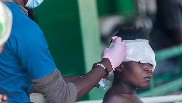 Una mujer herida es atendida en un hospital en Les Cayes el 15 de agosto de 2021, luego de que un terremoto de magnitud 7.2 sacudiera Haití. (REGINALD LOUISSAINT JR / AFP).