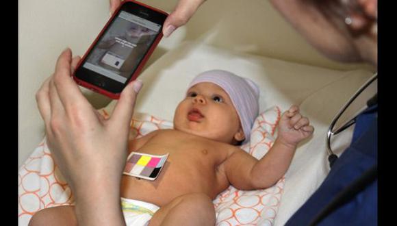 Esta app detecta en minutos ictericia en neonatos