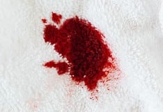 Cómo sacar manchas de sangre de la alfombra