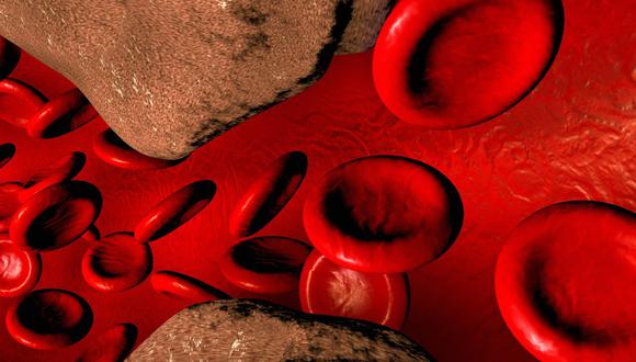 Determinados tipos de lipoproteínas, cuando se elevan demasiado, corren serios riesgos de incrustarse en las paredes de nuestras arterias produciendo las temidas placas de ateroma.