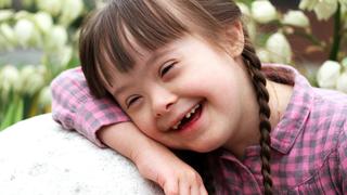Síndrome de Down | ¿Por qué ocurre este trastorno genético?