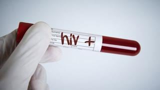 VIH/sida | Cuáles son los países de América Latina con mayor aumento de nuevos contagios