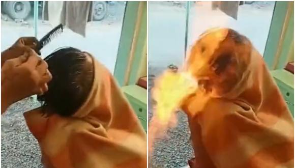 Corte de cabello con fuego deja a joven en hospital: video se volvió viral en redes. (Foto: @ravikumar455)
