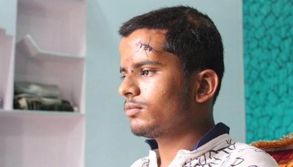 Mohammad Salman tiene varias heridas a causa de la golpiza. (Foto: BBC Mundo)