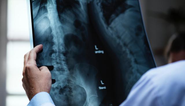 Los doctores quedaron impactados al conocer la razón por la que un hombre se quejaba de dolores en el pecho. (Fotos: Pexels/Referencial/Pear Video)