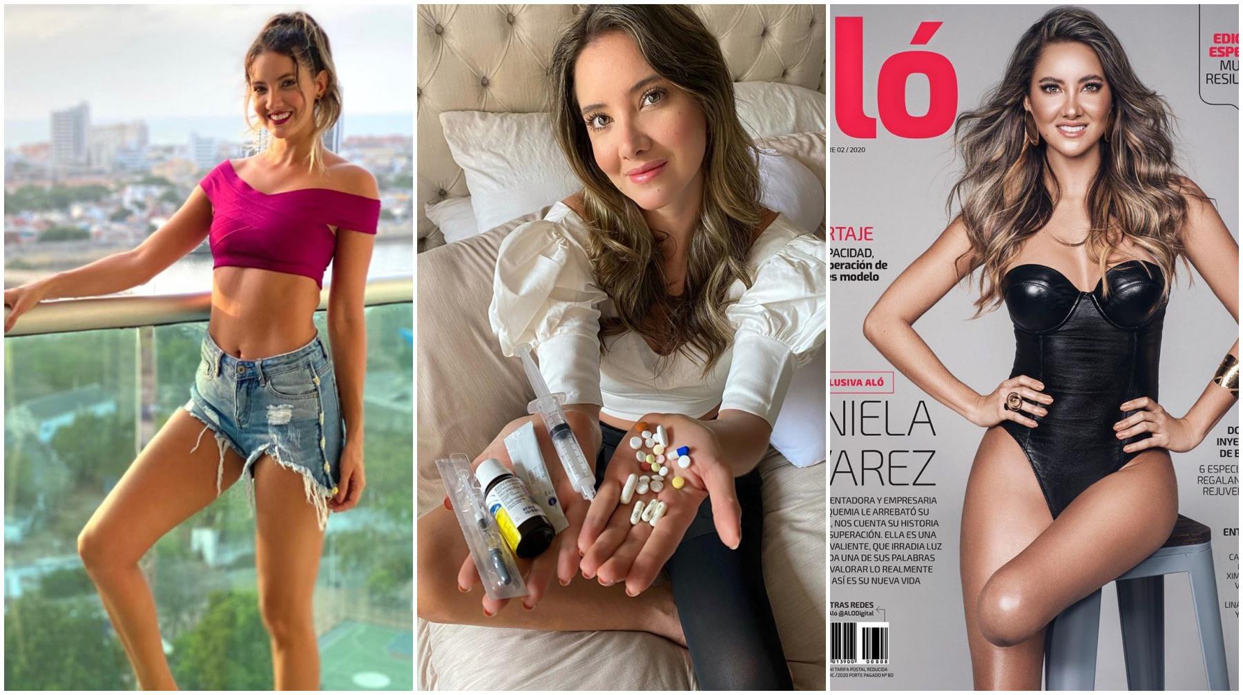 Daniella Álvarez, ganadora del concurso Miss Colombia 2011, sufrió la amputación de la pierna izquierda este 2020. En los meses desde la cirugía, ha buscado llevar una vida normal. Fotos: Danielaalvareztv en Instagram/ Revista Aló.