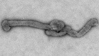 Descubren nuevo virus que ya cobró la vida de un paciente