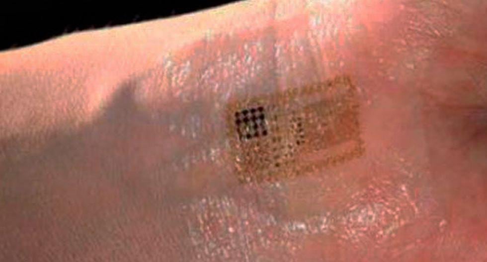 Un grupo de científicos  ha inventado un sensor electrónico que se puede adherir a la piel cómodamente para controlar el estado de salud de una persona. (Foto: Getty Images)