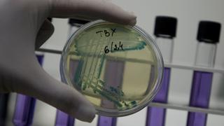 Crean un chip capaz de “oír” a las bacterias