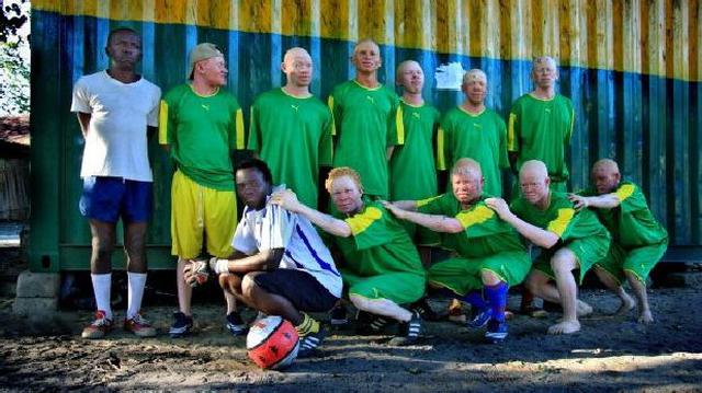 Albino United: el equipo cuya vida peligra cada vez que juega - 1
