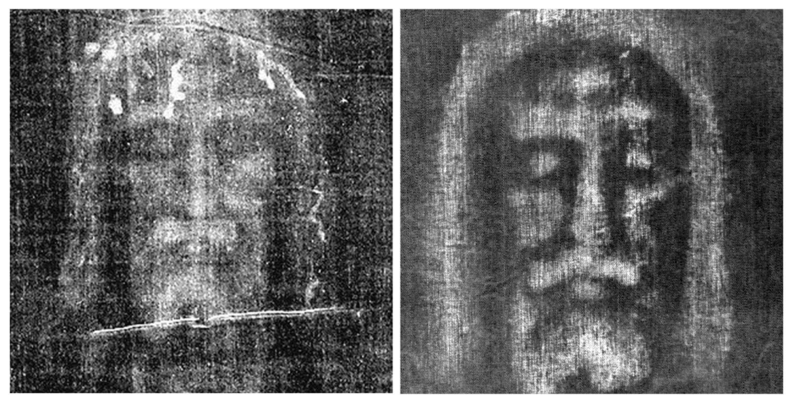 Vista del supuesto rostro de Jesús, algo que no ha sido comprobado científicamente. Aun así, la Sábana Santa es venerada por muchos católicos. (Foto: Agencia Reuters)