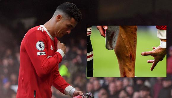 Cristiano y su molestia tras la derrota del United. (Foto: AFP)