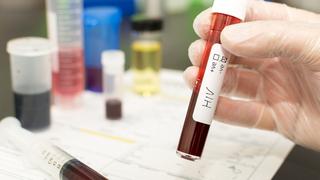 Nueva York: Primer caso de una mujer probablemente curada del VIH gracias a tratamiento con células madre