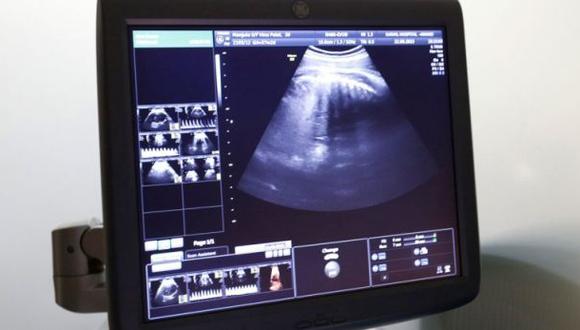 Chile: Hallan feto momificado en vientre de mujer de 92 años