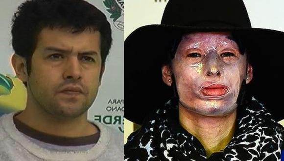 Colombia: Jonathan Vega, culpable por echarle ácido a una mujer