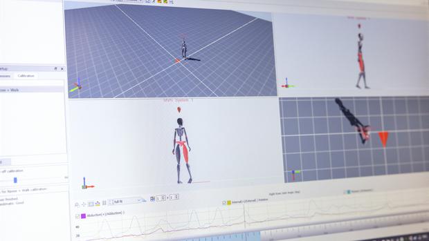 The movement is recorded and analyzed by an artificial intelligence system that is capable of assessing any deterioration in a patient twice as fast as the best doctors.  (THOMAS ANGUS/IMPERIAL COLLEGE)
