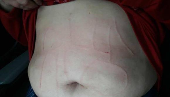 Argentina: Secuestran y torturan a maestra escribiéndole amenaza en el abdomen (Foto: Facebook)