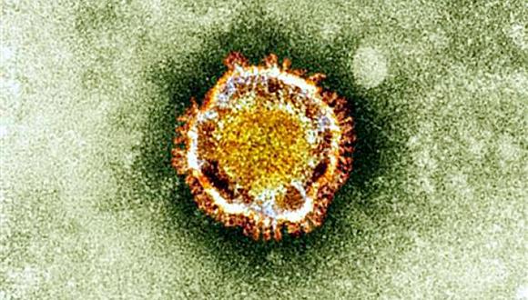 El nuevo coronavirus produce neumonía. (Foto: HO / BRITISH HEALTH PROTECTION AGENCY / AFP)